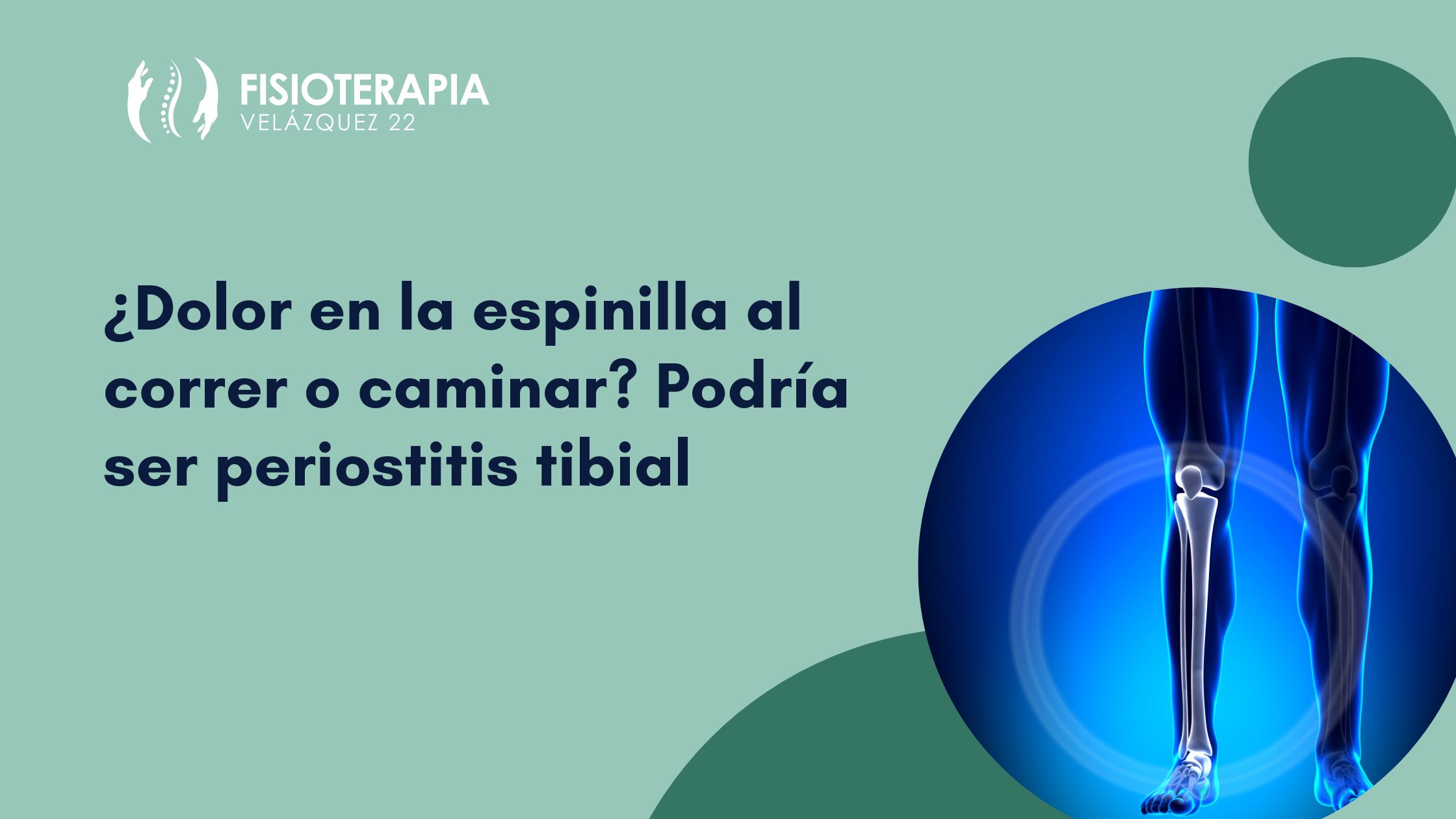 ¿Dolor en la espinilla al correr o caminar? Podría ser periostitis tibial