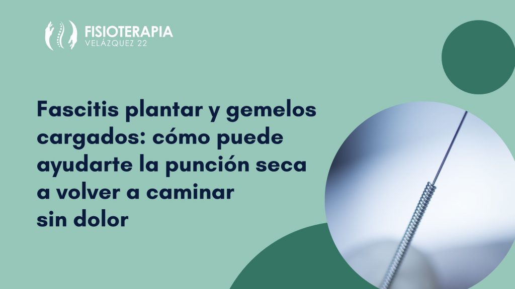 Aguja utilizada en tratamientos de punción seca para aliviar la fascitis plantar