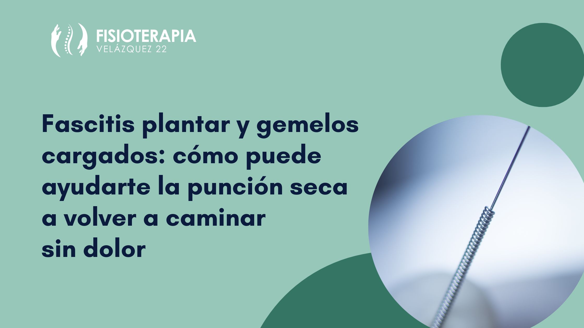 Fascitis plantar y gemelos cargados: cómo puede ayudarte la punción seca a volver a caminar sin dolor